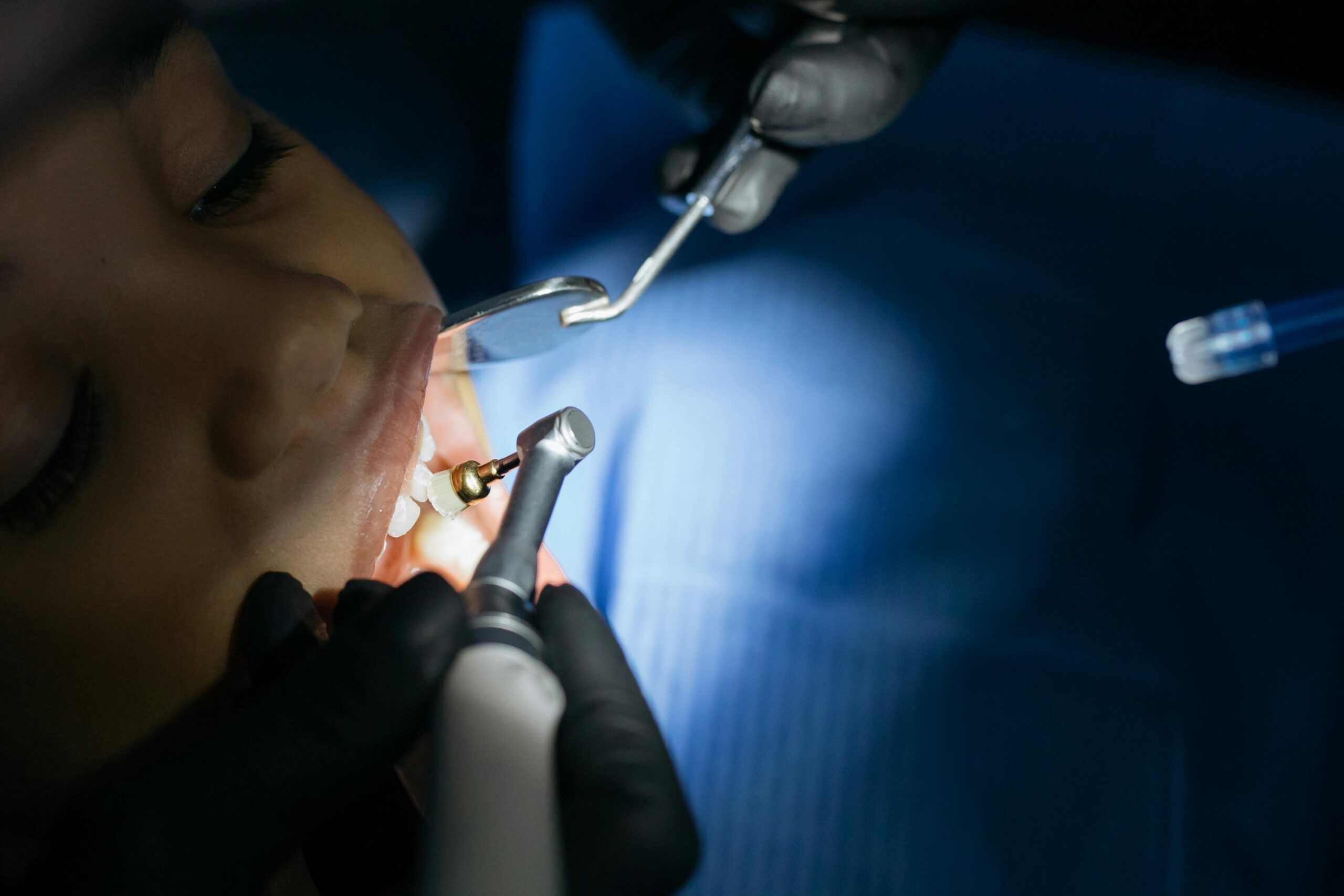 Close-up of a child receiving a dental checkup in a modern clinic with professional tools.